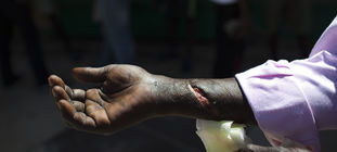 Foto: Desalambre de eldiario.es