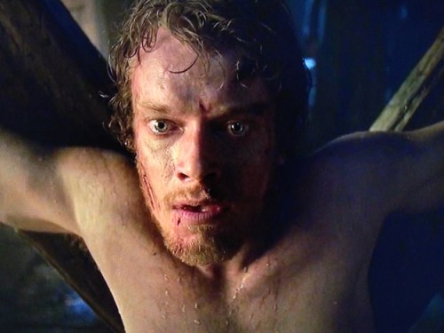Theon Greyjoy de Juego de Tronos que deviene en el personaje de Hediondo tras ser torturado